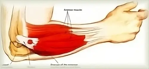 sore elbow outside