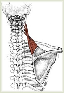 pain in neck can't turn head