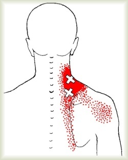 neck pain can't turn head