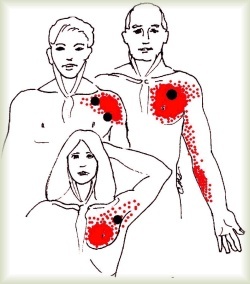 pectoralgia pain in left chest area