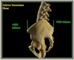 lower back pain right side when bending forward