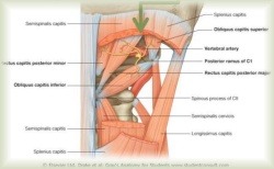 pinched vertebral artery when turning head